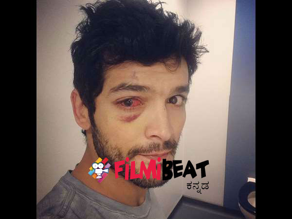 ಶೂಟಿಂಗ್ ನಲ್ಲಾದ ಅವಗಡದಲ್ಲಿ ದಿಗಂತ್ ಬಲಗಣ್ಣಿಗೆ ಬಲವಾದ ಪಟ್ಟು ಬಿ ದ್ದಿದೆ