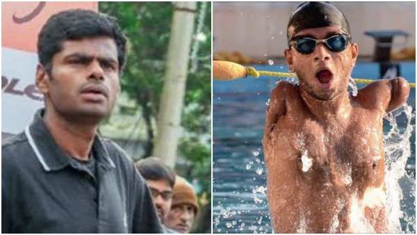 ವಿದ್ಯುತ್ ಸ್ಪರ್ಶಕ್ಕೆ ಕೈಗಳನ್ನು ಕಳೆದುಕೊಂಡಿರುವ ವಿಶ್ವಾಸ್